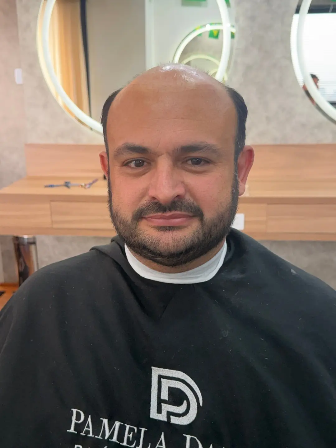 Cliente 02 antes da aplicação da prótese capilar